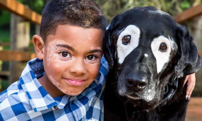 Un niño supera depresión al conocer un perro con su misma afección