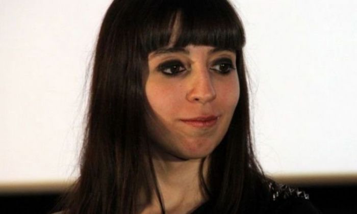 Cristina Kirchner le informó a la Justicia que Florencia padece linfedema