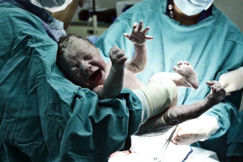 Los bebés nacidos por cesárea tienen más microbios potencialmente peligrosos