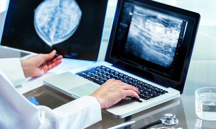 Aplican Inteligencia Artificial para un mejor diagnóstico de las mamografías