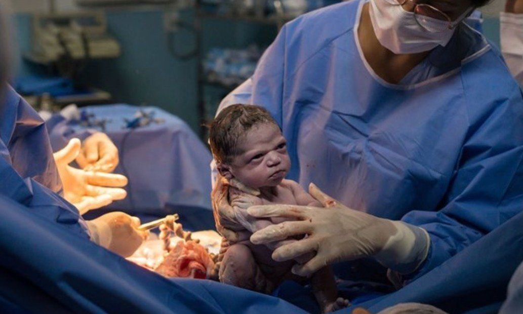 La foto que da la vuelta al mundo: la beba que nació enojada