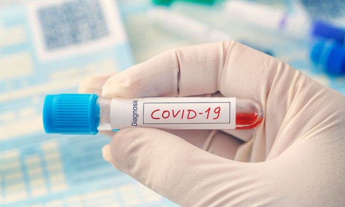 Autopsias a pacientes con coronavirus revelan nuevos hallazgos sobre la enfermedad