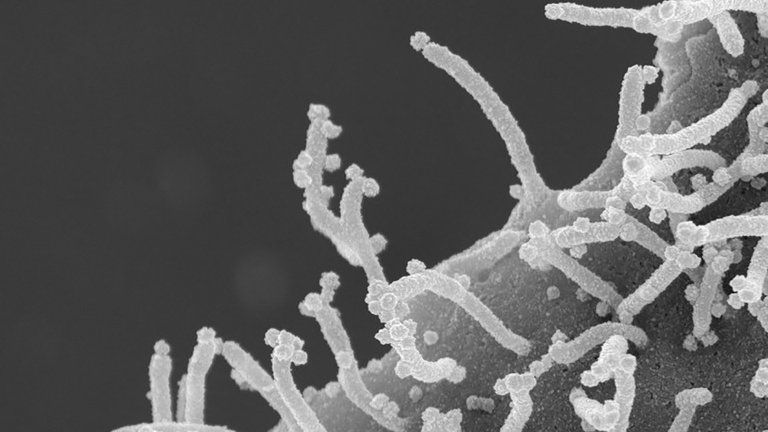 Las sorprendentes fotos de cómo ataca el coronavirus a las células humanas