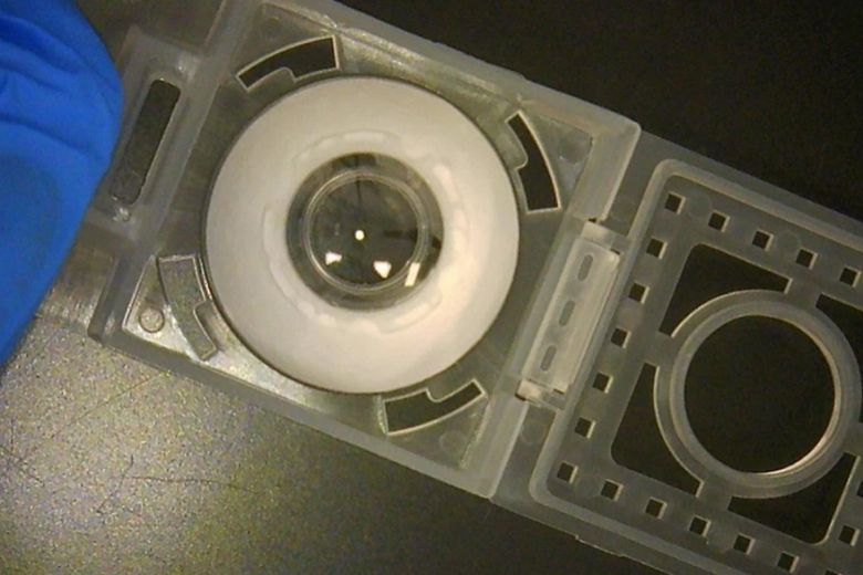CorNeat Kpro: esta es la córnea artificial que le devolvió la vista a una persona ciega