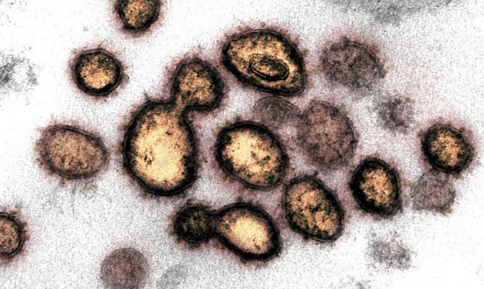 Un informe de la ONU advierte sobre 1,7 millones de virus aún no descubiertos