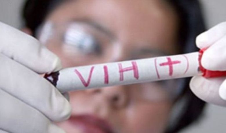 HIV: "Se ha perdido el miedo y eso no quita que la gente se contagie"