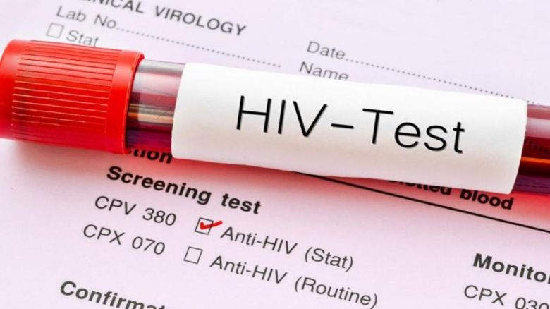 HIV: "Se ha perdido el miedo y eso no quita que la gente se contagie"