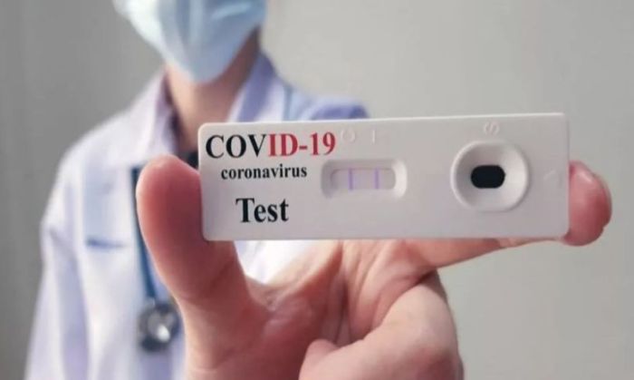 La Anmat autorizó el uso de un quinto test de autoevaluación de coronavirus
