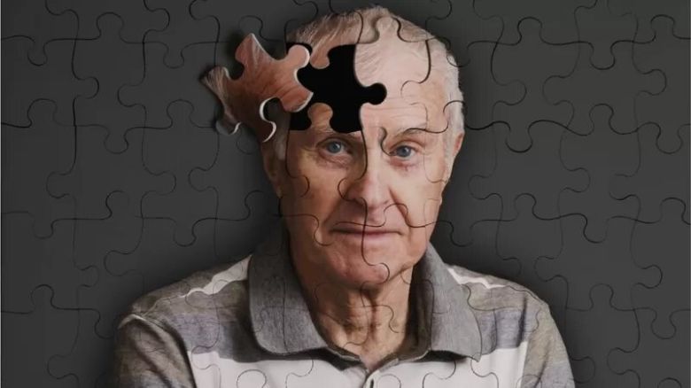 ¿Qué es la demencia vascular y en qué se diferencia del alzhéimer?