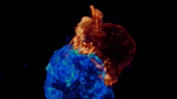 El increíble vídeo que muestra cómo una célula del sistema inmune ataca al cáncer
