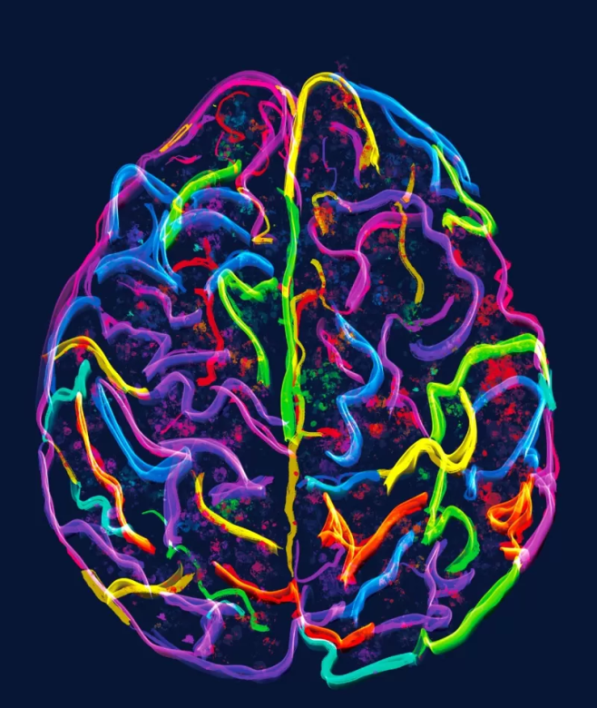 Qué es la reserva cognitiva y por qué debemos trabajar en ella para cuidar nuestro cerebro