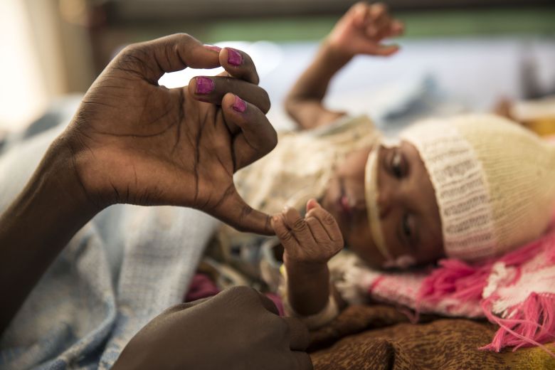 MSF: “Tristemente en la actualidad estamos en 80 países, con 500 proyectos de acción sanitaria”