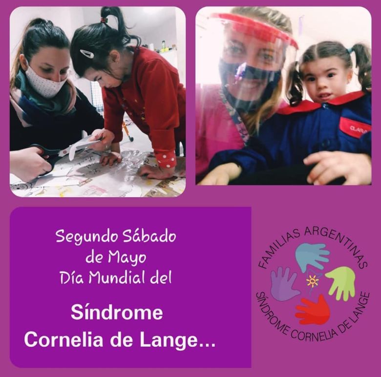 Síndrome Cornelia de Lange: trastorno genético poco conocido y que requiere voluntad de los padres