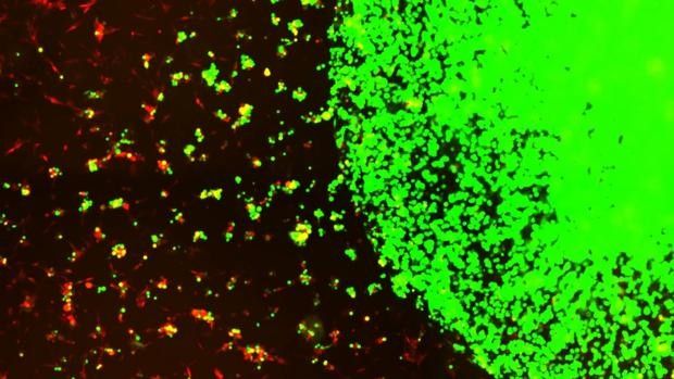 Diseñan células madre modificadas para tratar un cáncer cerebral muy agresivo
