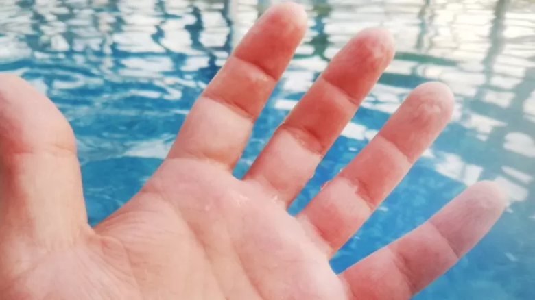 Los sorprendentes beneficios de que los dedos se arruguen en el agua