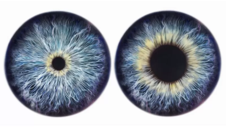 Por qué nuestros ojos pueden cambiar de color con los años