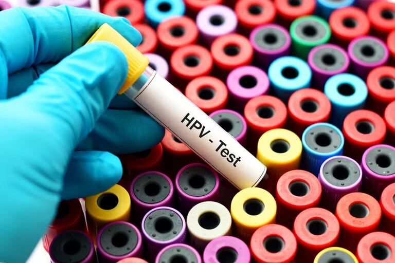 La importancia de los chequeos para detectar el VPH, responsable de más de 600 mil casos de cáncer en el mundo al año