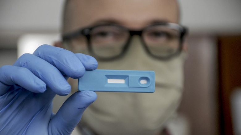 Científicos argentinos crearon el test que detecta coronavirus en cinco minutos