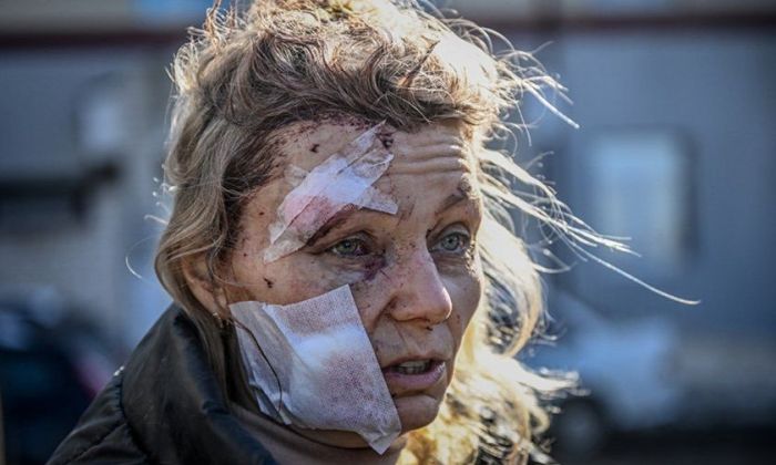 La ONU confirmó más de 500 civiles muertos en Ucrania