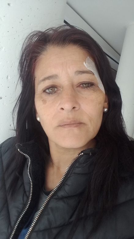 Se recupera favorablemente la mujer asaltada en Banda Norte en la tarde del lunes