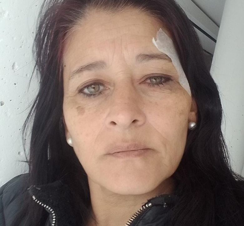 Se recupera favorablemente la mujer asaltada en Banda Norte en la tarde del lunes