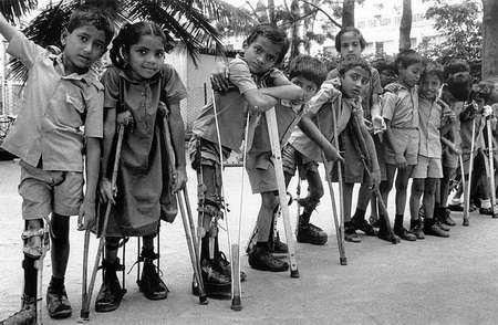 Preocupación por algunos casos de rebrote de la poliomielitis